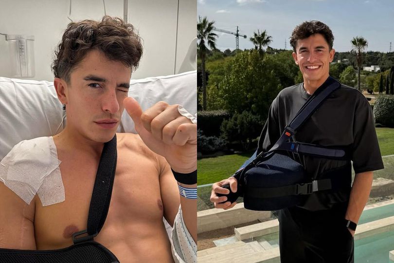 Tak Ada Kemajuan Usai 7 Hari, Marc Marquez Akhirnya Putuskan Jalani Operasi Bahu