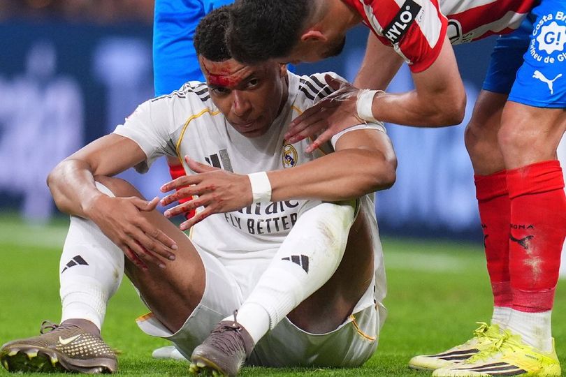 Kontroversi dari Kekalahan Real Madrid: Mbappe Disikut Sampai Berdarah, tapi VAR Hanya Diam