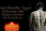 Agger