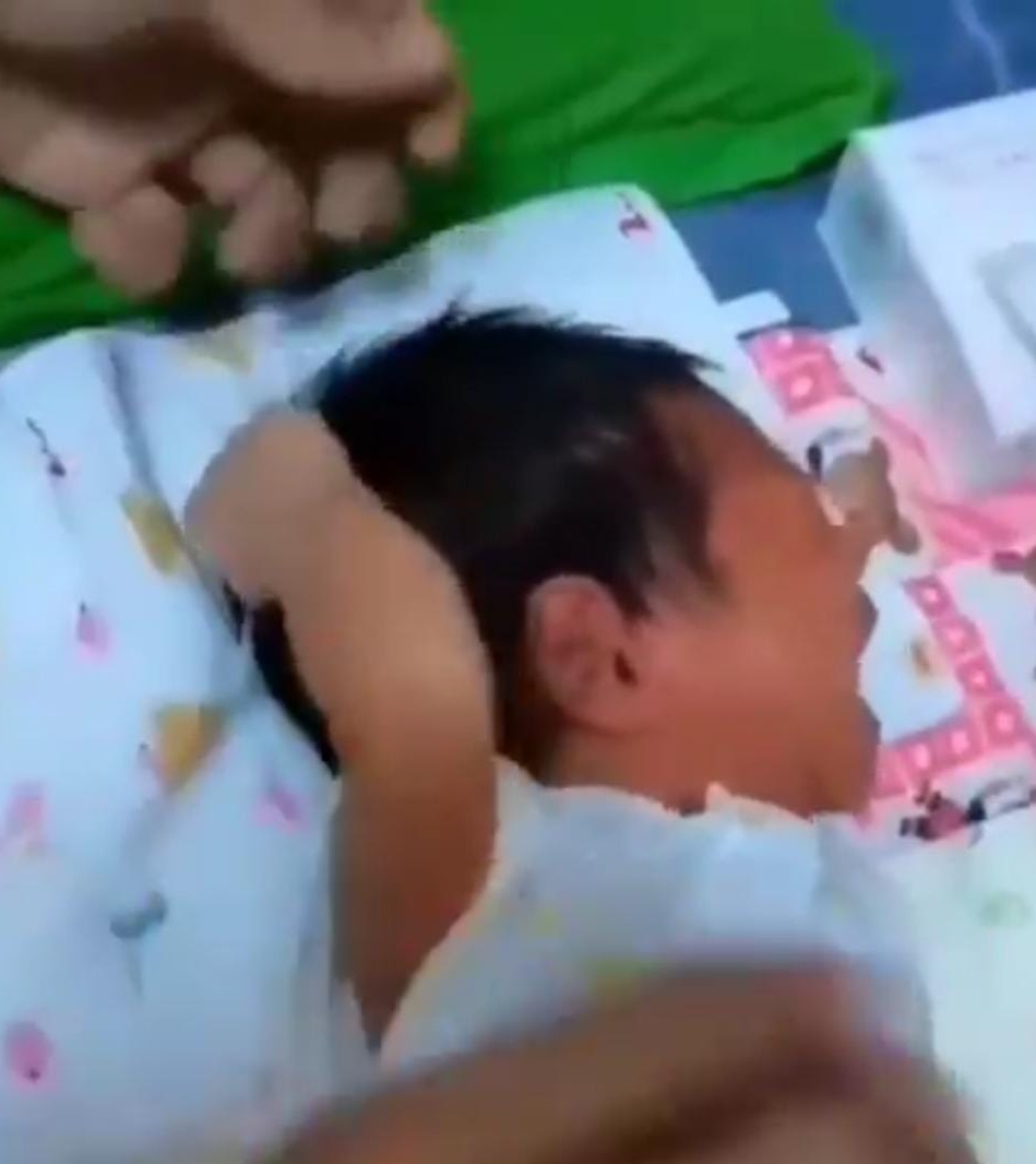 Bayi Nangis Jambak Rambut Sendiri