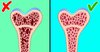 6 Cara Menghindari Osteoporosis