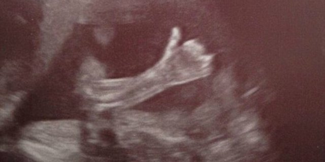 Bayi Acungkan Jempol Saat Ibunya Foto USG