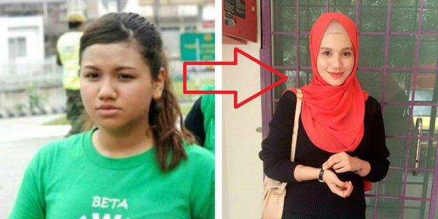 Bungkam Haters, Perubahan Gadis Ini Bikin Geger Dunia