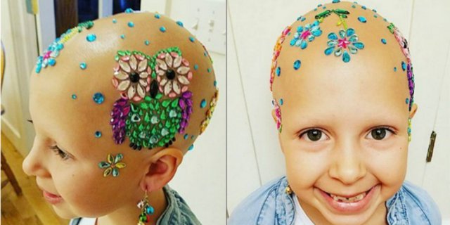 Cerita Bahagia Gadis Kecil yang Kepalanya Dipenuhi Stiker