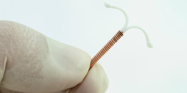 Pakai Kontrasepsi IUD Bisa 'Bobol', Lihat Buktinya