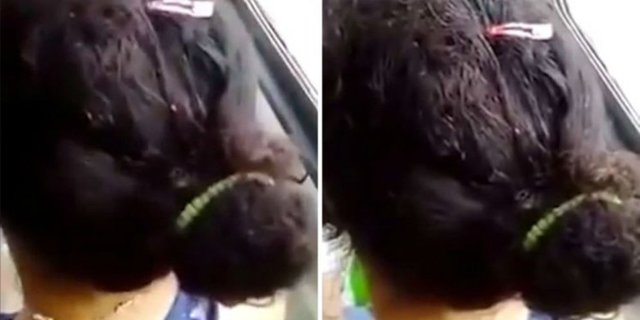`Peternakan` Kutu di Rambut Wanita Ini Bikin Merinding