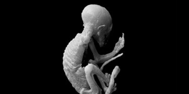 Cerita Sebenarnya `Bayi Alien` yang Kecoh Ilmuwan