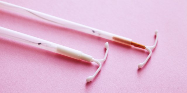 Dikira Copot, IUD Ternyata Bersarang di Perut Selama 11 Tahun