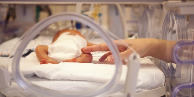 5 Cara Merawat Bayi Prematur dan Kurang Berat Badan