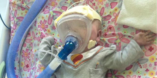 Perjuangan Bayi 6 Bulan dengan Kelainan Jantung Melawan Covid-19