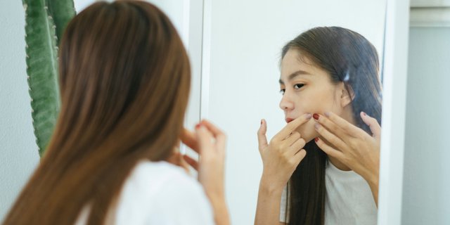 3 Bahan Alami yang Dapat Mengatasi Rosacea