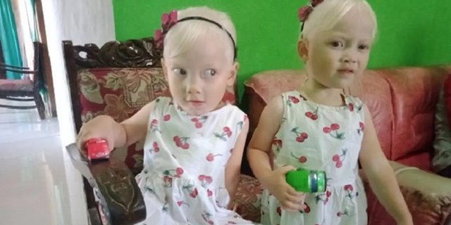 Viral Anak Kembar Bule Asli Wonogiri, Orangtuanya Sering Dikira Pembantu