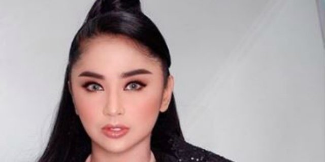 Pamer Foto Tangan Lebam, Dewi Perssik: Biasa sayang`