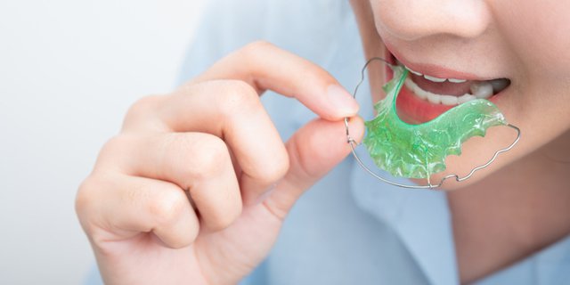 How Important is Wearing Retainer After Removing Braces or Aligners?