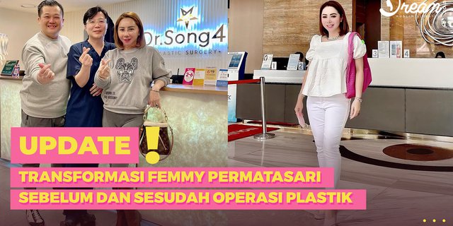 Femmy Permatasari's Face Transformation Before and After Plastic Surgery