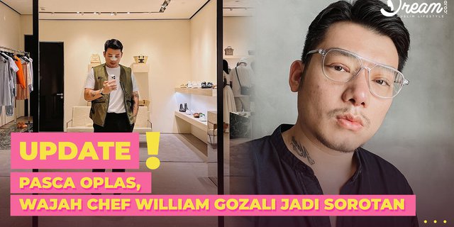 After Plastic Surgery, Chef William Gozali's Face Becomes the Spotlight