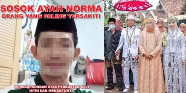 This is the figure of Norma Risma's Father Known as Patient, Netizens: His Heart Must Be Shattered