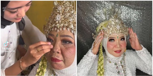 Makeup Bride That Has Slipped Away Due to Skin Treatment, Transformed by MUA to Look Beautiful Again