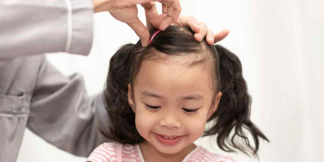 Aksesori Rambut Bisa Bahayakan Anak, Simak Penjelasan Dokter