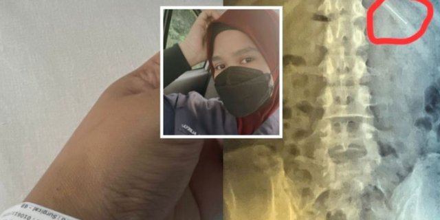 Innalillahi! Want to Wear Hijab, This Woman Accidentally Swallowed a Pin, Here's the End of the Story