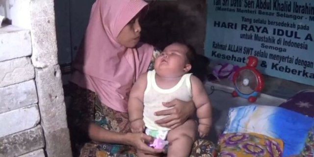 After Fajri Tangerang, Baby in Bekasi Suffers from Obesity, 7-Month-Old Weighs 15.5 Kg