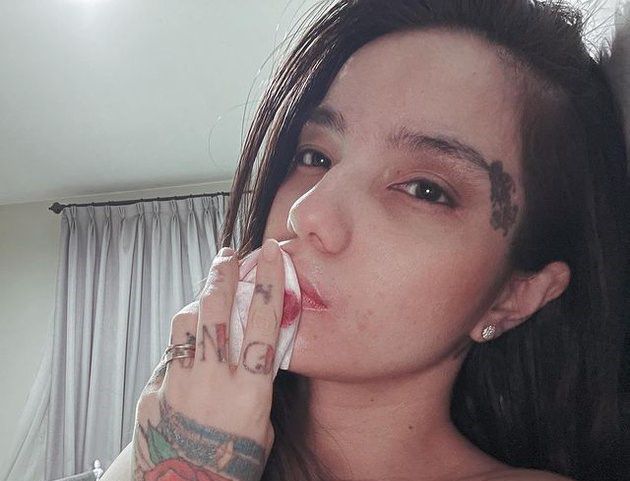 Sheila Marcia Hapus Tato Pamer Bekas Luka Di Tubuh