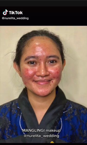 Potret Transformasi Wanita Berjerawat Dirias MUA Jadi Pengantin Jawa, Hasilnya Bikin Pangling!