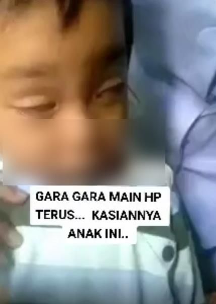 Bocah Ini Tak Bisa Membuka Mata dengan Wajar 