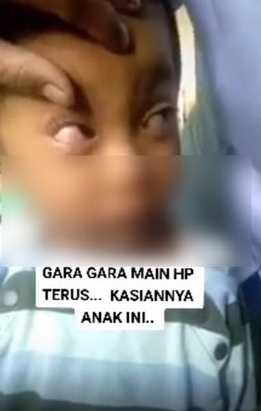 Bocah Ini Tak Bisa Membuka Mata dengan Wajar 