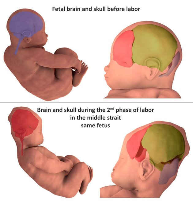 Fetal Brain