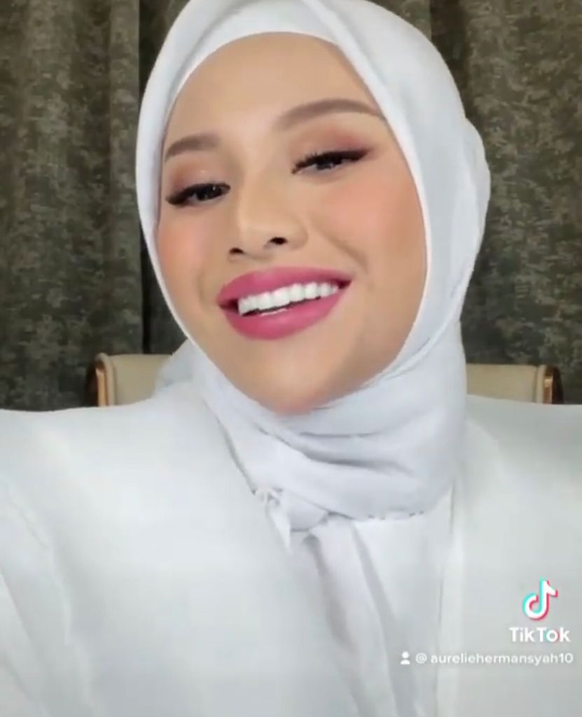 Gigi Aurel Hermansyah Setelah Melakukan Veneer