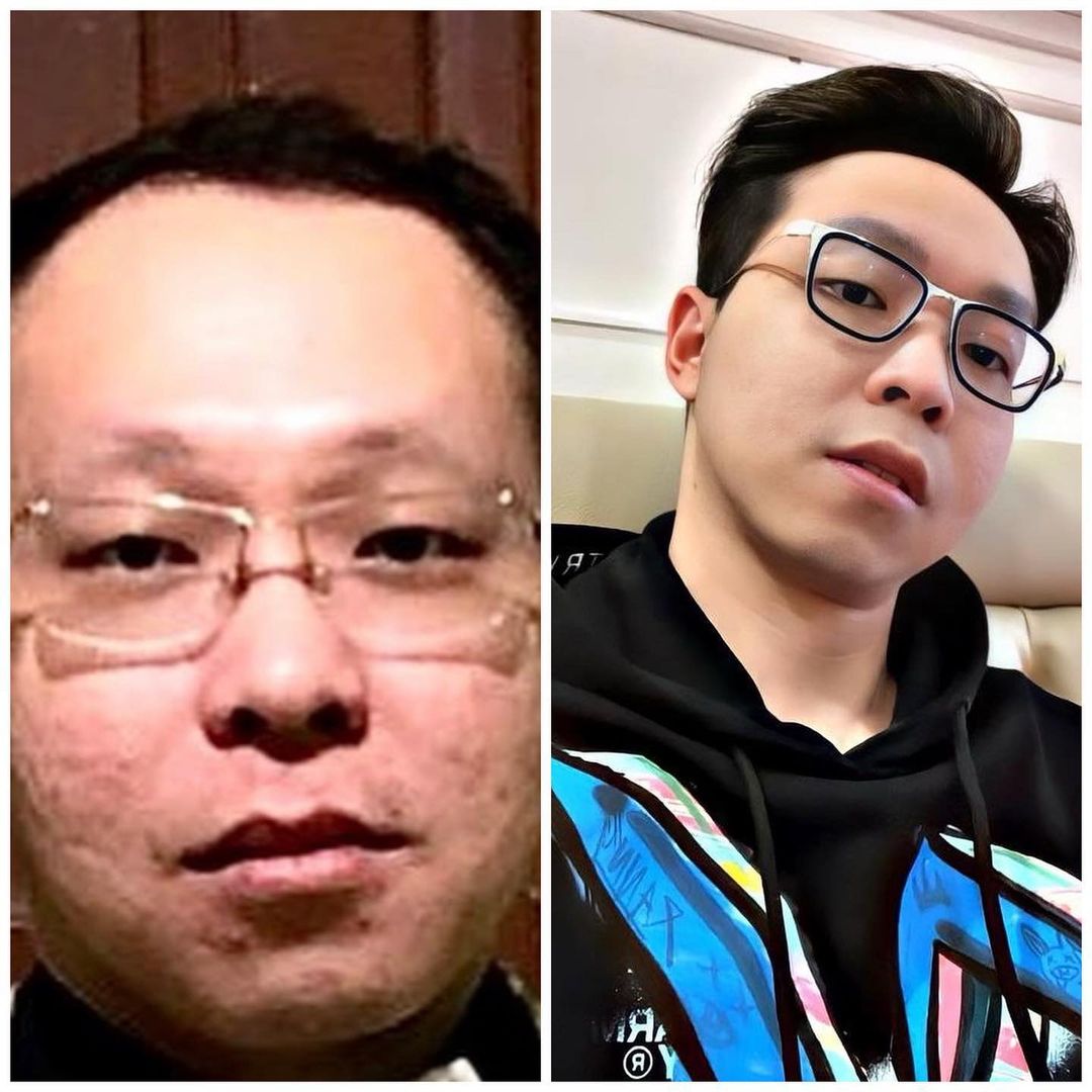 Appearance of Doctor Richard Lee before and after treatment