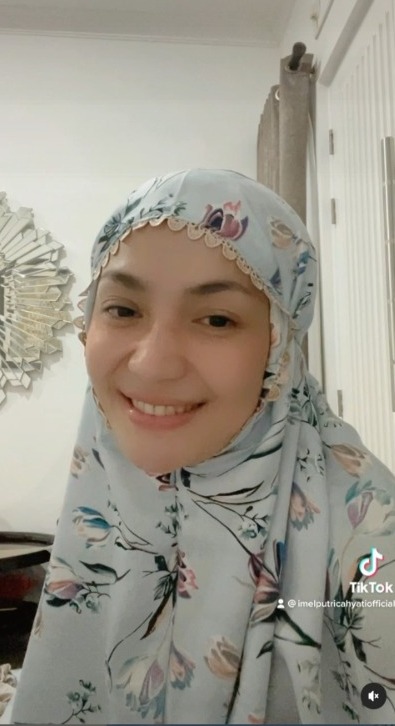 Disebut Mirip Banget, Adu Pesona Citra Kirana dan Imel Putri Cahyati