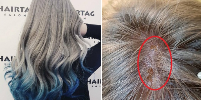  Bleaching  Rambut  3 Jam Lihat Akibatnya Dream co id