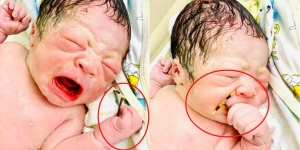 Heboh! Bayi Lahir dengan Menggenggam Alat Kontrasepsi, Dapat dari Mana?