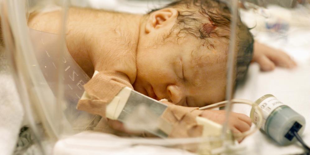 Kisah Tragis Ibu di NTT Lahiran di Kamar Mandi dan Tarik Bayinya Secara Paksa