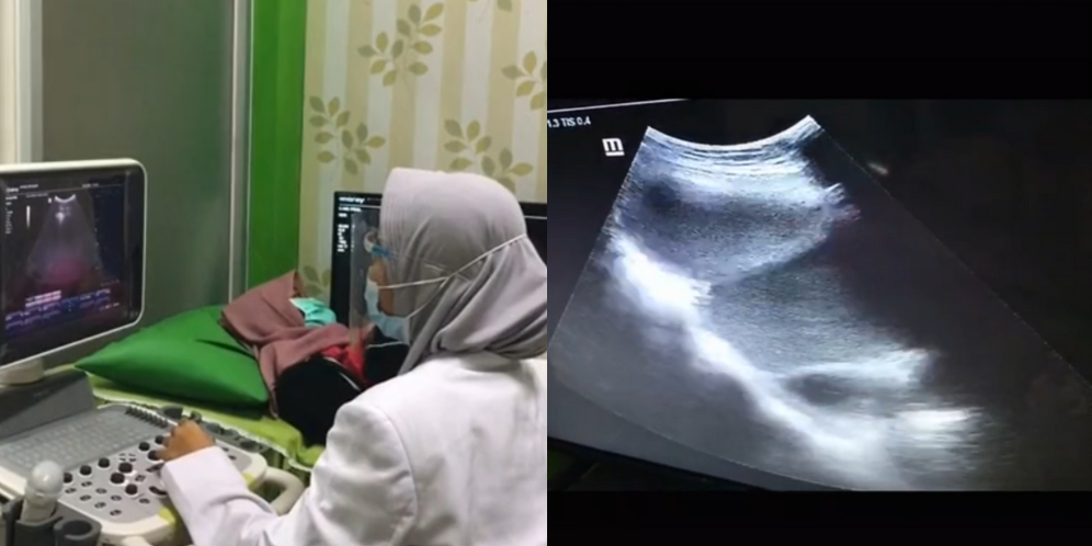 Hasil Test Pack Positif, Wanita Pucat Kandungan 9 Bulan Bukan Berisi Bayi Tapi..