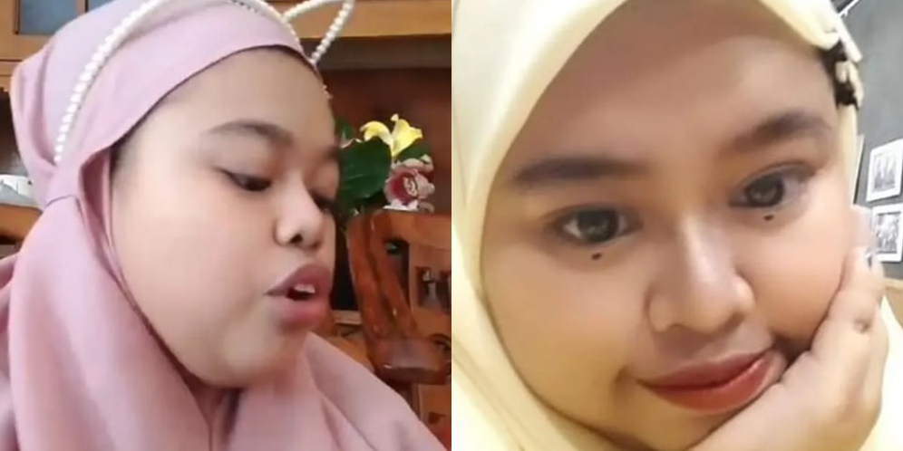 Potret Kekeyi Setelah Filler Hidung, Foto Before-After Viral