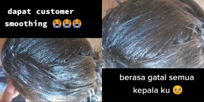 Ada Pelanggan Mau Smoothing, Syok Lihat Rambut Penuh Kutu dan Telur