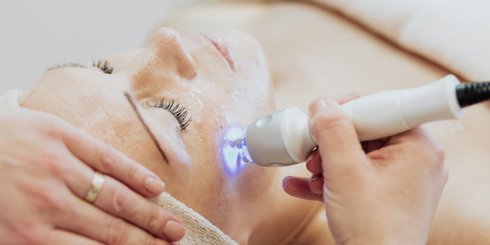 4 Manfaat Laser Fotona untuk Kecantikan Kulit Wajah