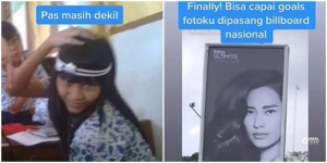 Pas Sekolah Dibully, Sekarang Fotonya Nampang di Billboard Nasional