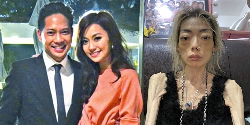 Model Cantik Ini Dinikahi Pria Tajir, Kini Kondisinya Berubah Mengenaskan, Lihat 8 Potretnya!