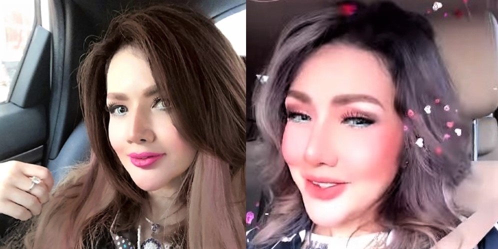 10 Potret Terbaru Barbie Kumalasari Usai Operasi Hidung Rp50 Juta, Berubah Drastis Makin Cantik!