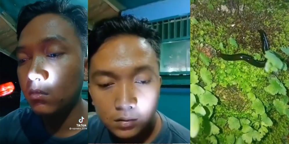 Ngeri! Pemuda Ini Tak Sadar Hidungnya Kemasukan Lintah Penghisap Darah, Netizen Salfok sama Ekspresinya yang Santuy