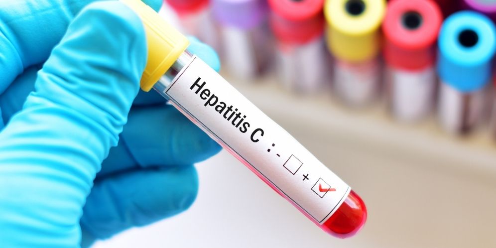Hepatitis Akut Misterius Intai Anak-Anak, Begini Cara Penanganan dan Rekomendasi Obatnya