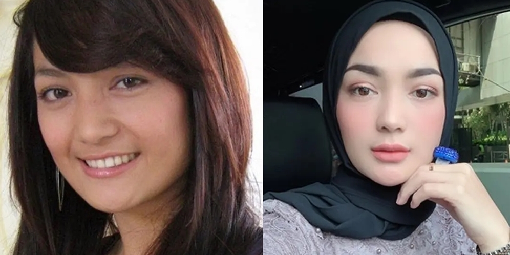 Ingat Imel Putri, Ratu Drama Kolosal Tercantik? Dikabarkan Derita Kanker Langka, Begini Kabar dan Kondisinya Sekarang