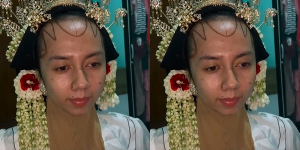 Potret Transformasi Makeup Pengantin dengan Wajah Bekas Cacar, Ternyata Hasilnya Diluar Dugaan!