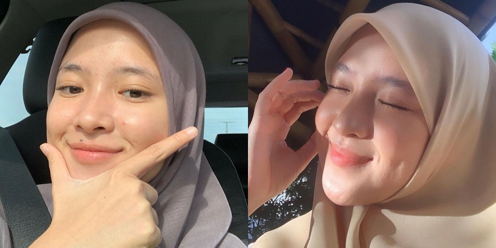 Potret Nissa Sabyan Pamer Close Up Wajah, Warna Matanya Bikin Salfok!