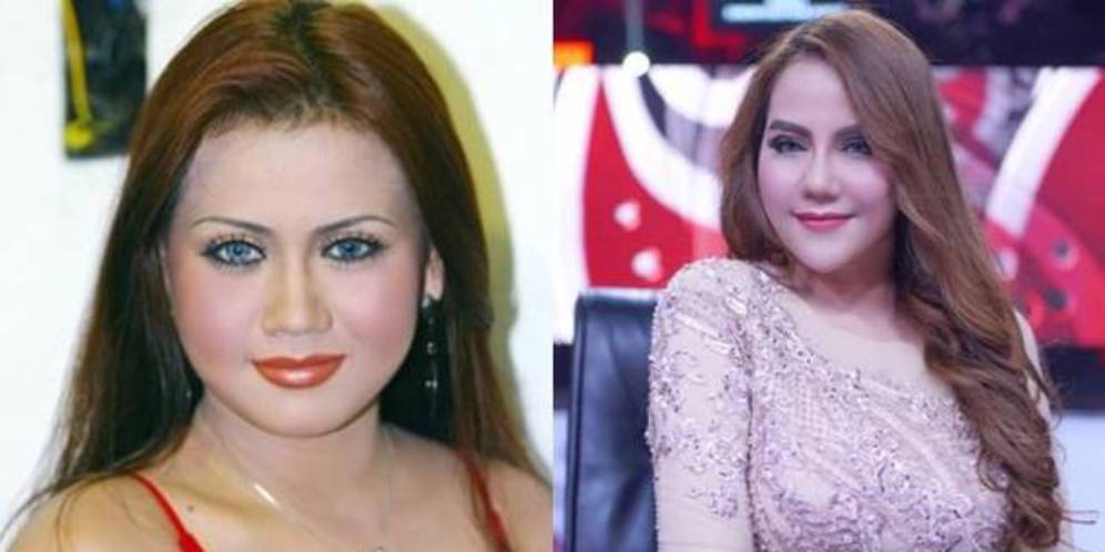 Beda Banget dan Manglingin! Foto Artis Sebelum dan Sesudah Oplas