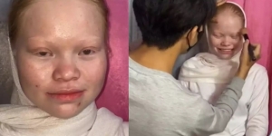 8 Transformasi Wanita dengan Kelainan Langka Albino Dirias MUA Jadi Pengantin Sunda, Hasilnya Super Unik!
